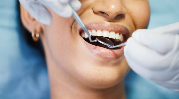 Best Emergency Treatment for Dental Infections or Abscesses in Americus, GA